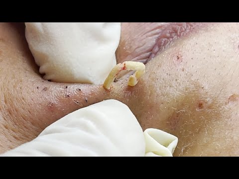Suri Nguyen Spa