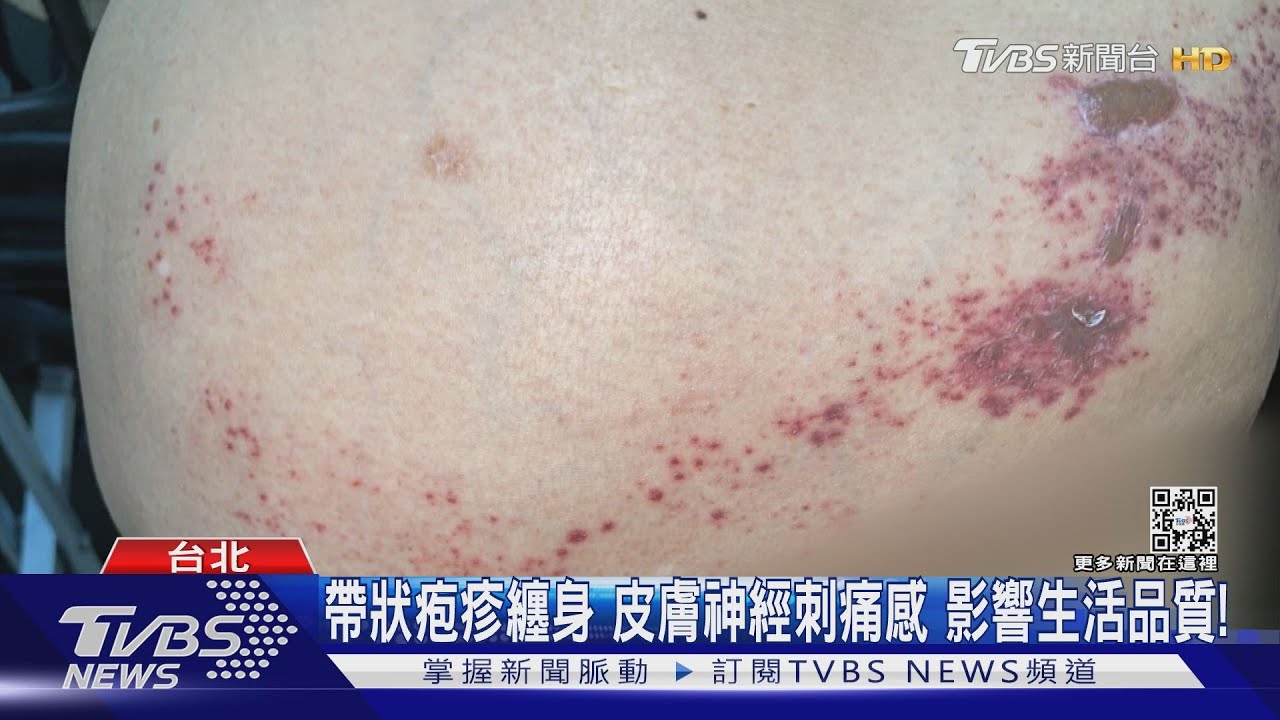 罹「這疾病」痛不欲生!關鍵是它 醫:任何年紀都可能會發生