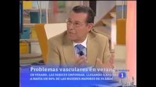 Problemas vasculares - Doctor Balanzino en TVE1 - Dr. Raúl Balanzino Maggi