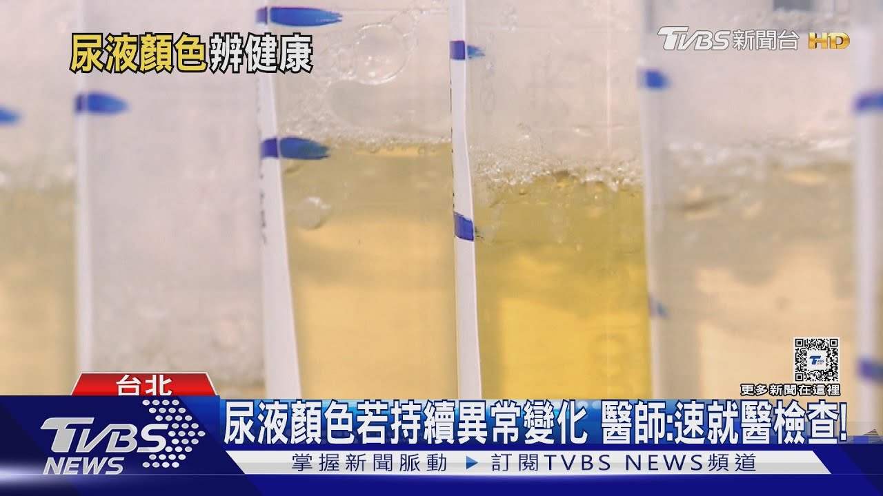 尿液出現「這顏色」罹癌機率增　醫師：應積極追蹤檢查