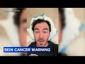 Kevin Jonas Gets Surgery To Remove Basal Cell Carcinoma Skin Cancer