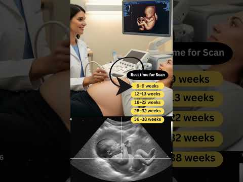 Best Time for Ultrasound Scan | Week-by-Week Pregnancy Ultrasound Guide