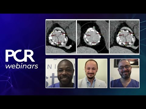 How should I treat my TAVI patients today and ensure future coronary access? - Webinar