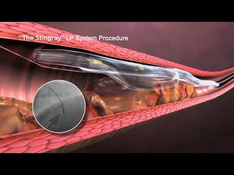 Boston Scientific Coronary CTO System Overview