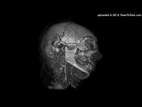 [FREE] *HARD DNB* NASCAR ALOE x AFOURTEEN TYPE BEAT - "brain failure" (prod. by BLXXDYBOY x Delixe)