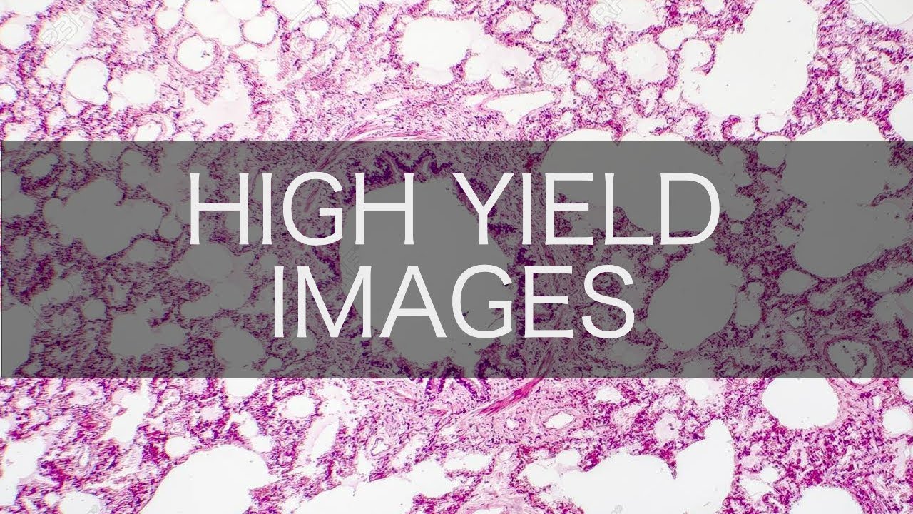 High Yield USMLE/COMLEX Images (pt. 6)