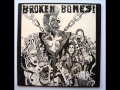 Broken Bones - Dem Bones - Side 1 [Full LP vinyl rip]