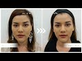 เมโสแฟต ยี่ห้อไหนดี