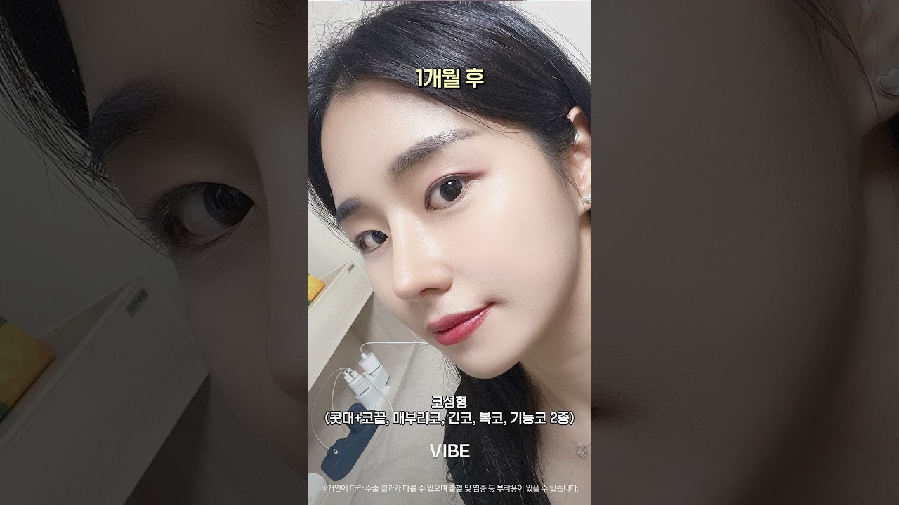 코성형(콧대+코끝, 비중격, 귀연골, 매부리코, 긴코, 복코, 기능코2종)