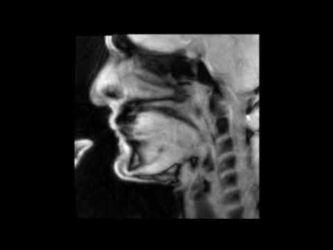 Douglas Yeo, trombone - MRI video 3 - articulated arpeggio