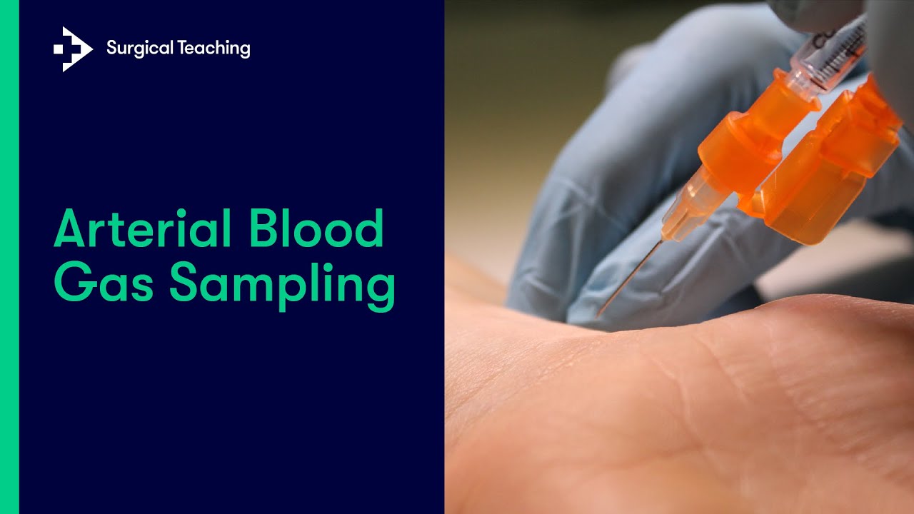 Arterial Blood Gas (ABG) Sampling | Everything You Need to Know to Perform this Vital Procedure
