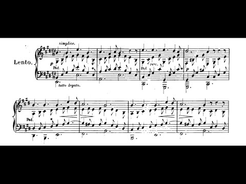 Thalberg — Romance sans paroles in E Major (Op.41, No.1) (Burkhardt)