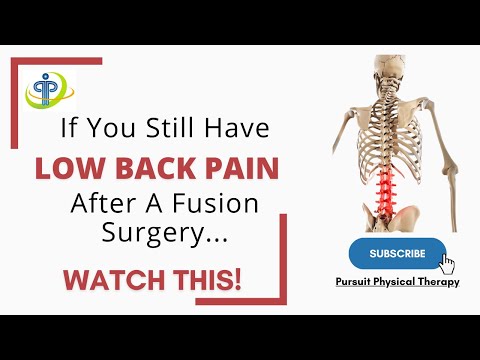 What To Do If You Still Have Low Back Pain After a Lumbar Fusion Surgery |  Orlando Treatment