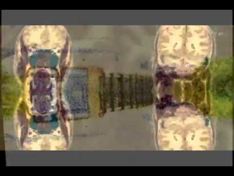 herr ungerade - 404 der morgen blueht