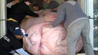 12 Weirdest Child Births