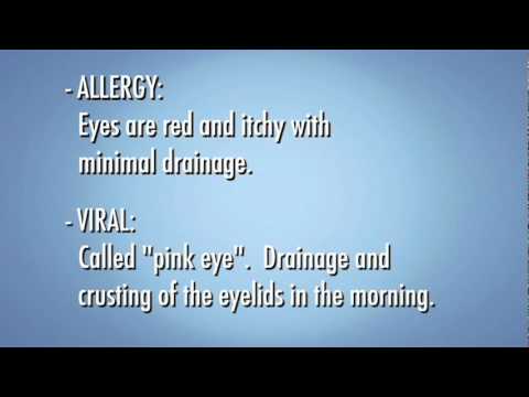 Causes of Red Eye