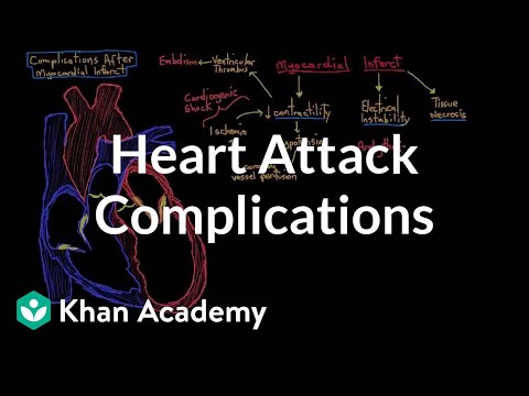 Complications after a heart attack (myocardial infarction) | NCLEX-RN | Khan Academy