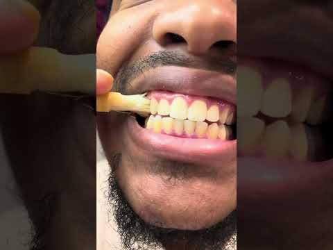 Rediscovering the power of natural oral care with miswak sticks