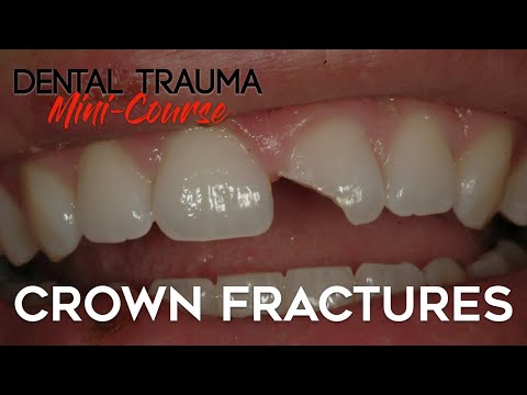 Dental Trauma Mini-Course - Part 4 - Dental Trauma Guide - Crown Fractures