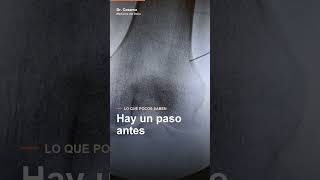 Radiofrecuencia de rodilla (geniculados): cómo alivia el dolor de artrosis | Dr. Casarsa