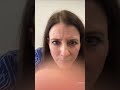 Let S Talk About Your Vulva Pelvicpain Pelvicpt Vulva Vulvacare Women S Health