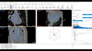 How to Semi-Automatically Segment Heart with CT Heart Tool