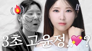 저보고 3초 고윤정이래요 1편 (수술 전) ㅣ성형비포에프터 ㅣ 뷰티라인성형외과