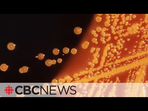 What E. coli symptoms should you be watching out for?