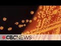 What E Coli Symptoms Should You Be Watching Out For