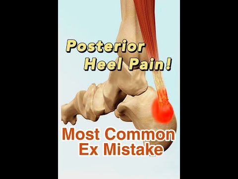 Insertional Achilles Tendinitis: The Biggest Ex Mistake!