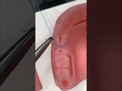 🔥Técnica de Sutura Dental en Forma de ❌🔥