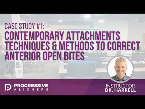 Case Study #1: Contemporary Attachments Techniques to Correct Anterior Open Bites | Dr. Harrell