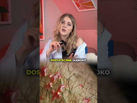 This is scabies 😭