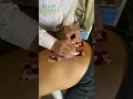 Kinesiology tape supports tissues #doctor #physiotherapy  #chiropractor #fitness #health #motivation