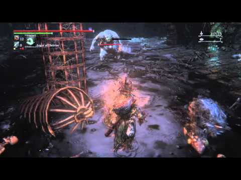 Moment in Gaming Bloodborne: Keep Rolling