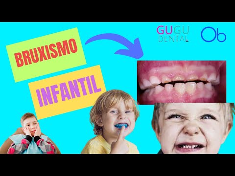 Bruxismo en niños 😬 👦 👧🏽 👶🏻