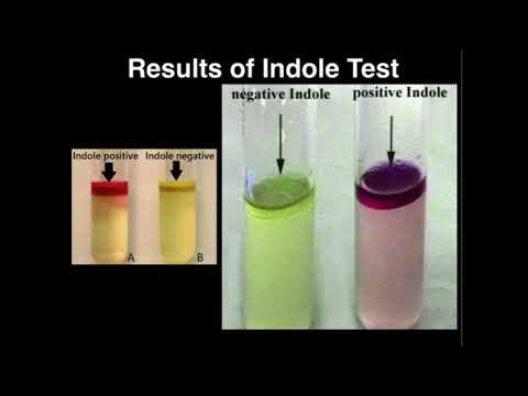 Microbiology: Indole Test (Tryptophanase)