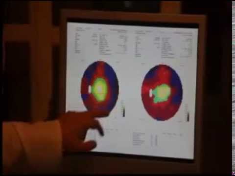 Lepa- Liechtenstein - Retinitis Pigmentosa Treatment - Usher Syndrom Therapy - Part 2  (Medical Results) 
