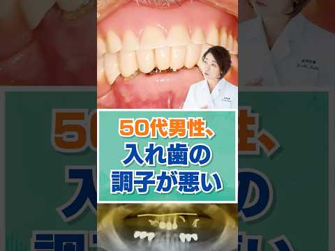 50代男性、入れ歯の調子が悪い