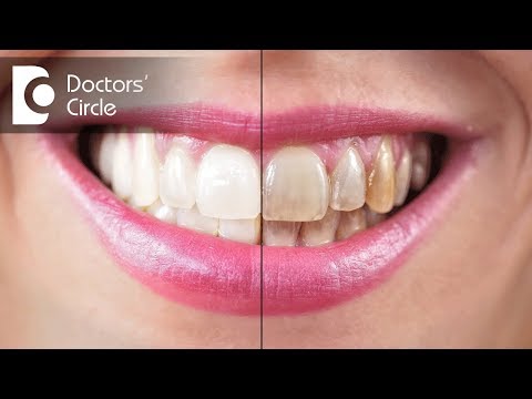 What causes stains on teeth in non smokers? - Dr. Aniruddha KB