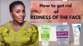 How to get rid of Redness of the face | how to clear redness of the face | causes of facial redness