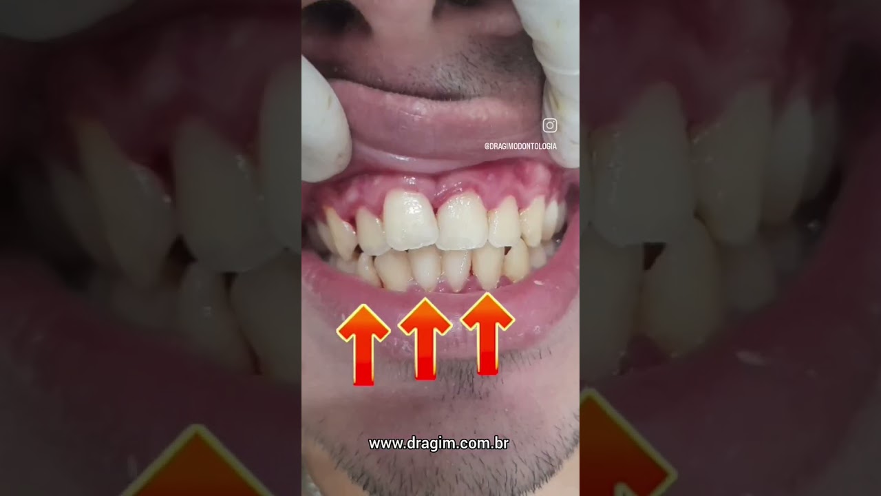 Gislene Isabel De Mendonça-47