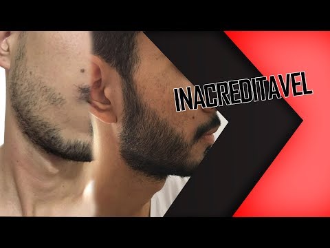 Lesercizio fisico aumenta la potenza negli uomini Varicocele potenza deboli