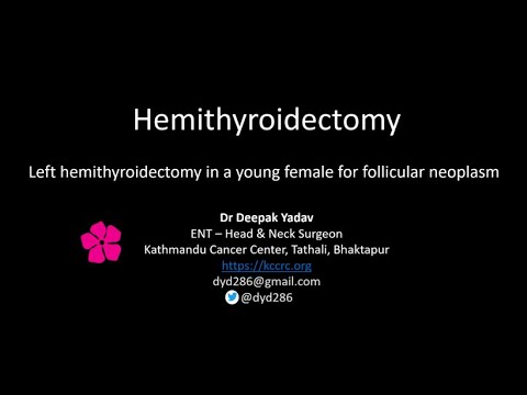 YouTube Video Thumbnail