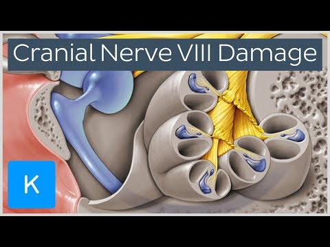 What happens when the vestibulocochlear nerve is damaged? - Human Anatomy | Kenhub