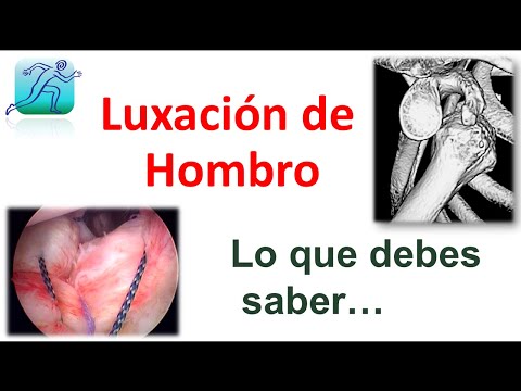 Pinzamiento del Hombro