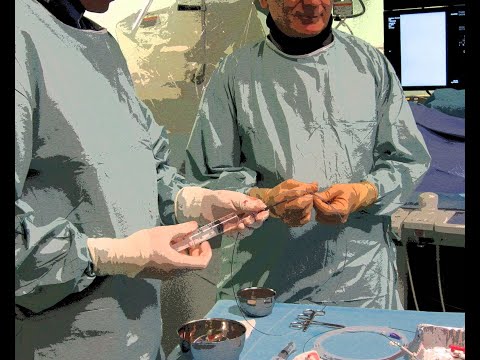 Routine Antegrade Femoral Approach: a lot of examples to familiarize with this crucial technique