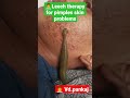 Leech Therapy For Skin Problems Pimples Ayurveda Skinproblems Shorts Panchkarma Hairfall Mp