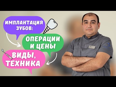 Имплантация зубов: операции и цены виды, техника #իմպլանտացիա #имплантациязубов #стоматологиямосква