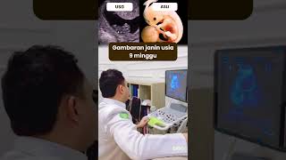 Download lagu 9-Week-Old Fetus Overview - Medikacare mp3